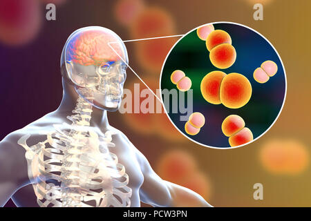 La Neisseria meningitidis infezione cerebrale, illustrazione del computer. N. meningitidis sono gram-negativi diplococci (batteri sferiche disposte in coppie), trasmessi tramite la via respiratoria. Nella maggior parte delle persone provocano infezioni asintomatiche o non gravi nasopharingitis, ma può anche causare gravi meningite e infezione generalizzata (meningococcaemia), in particolare per i bambini. La loro superficie è ricoperta con pilli che prendere parte in attacco di batteri per cellule e superfici. Foto Stock