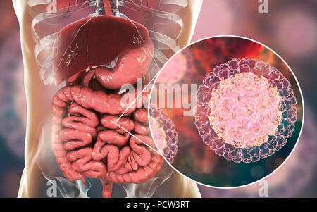 I rotavirus di infettare l'intestino, illustrazione del computer. La particella di virus consiste di un RNA (acido ribonucleico) nucleo circondato da una tripla capside stratificata. I rotavirus sono probabilmente i più comuni virus di infettare gli esseri umani e gli animali. Essi sono associati con la gastroenterite e diarrea - tipicamente di infettare gli intestini di bambini di età da 6 mesi a 3 anni. Il virus si diffondono nelle feci. Foto Stock