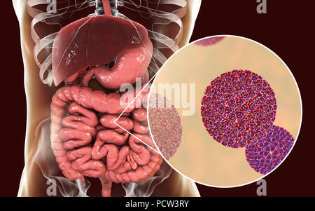 I rotavirus di infettare l'intestino, illustrazione del computer. La particella di virus consiste di un RNA (acido ribonucleico) nucleo circondato da una tripla capside stratificata. I rotavirus sono probabilmente i più comuni virus di infettare gli esseri umani e gli animali. Essi sono associati con la gastroenterite e diarrea - tipicamente di infettare gli intestini di bambini di età da 6 mesi a 3 anni. Il virus si diffondono nelle feci. Foto Stock