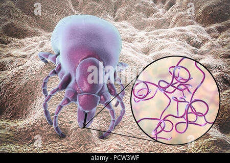 La malattia di Lyme tick, illustrazione. Le zecche (superfamiglia Ixodoidea) sono parassiti esterni che si nutrono di umano e il sangue animale. Il loro morso può trasmettere un certo numero di malattie tra cui la malattia di Lyme, che è causata dal batterio Borrelia burgdorferi. Foto Stock