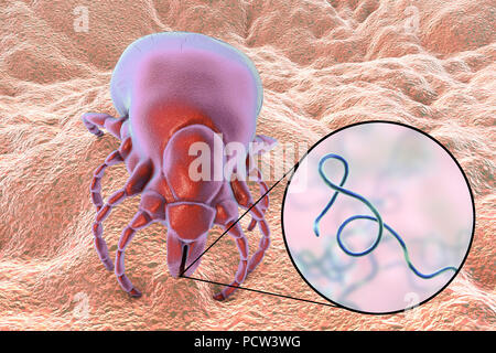 La malattia di Lyme tick, illustrazione. Le zecche (superfamiglia Ixodoidea) sono parassiti esterni che si nutrono di umano e il sangue animale. Il loro morso può trasmettere un certo numero di malattie tra cui la malattia di Lyme, che è causata dal batterio Borrelia burgdorferi. Foto Stock