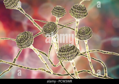 Computer illustrazione dei corpi fruttiferi (conidiofori) e hyphae del fungo Aspergillus fumigatus. A. fumigatus è ampiamente distribuito saprofita che cresce sulla polvere domestica, suolo, e decadenti materia vegetale, compresi cibo stantio, il fieno e i cereali. Gli esseri umani e gli animali inalano costantemente numerosi conidi di questo fungo. A. fumigatus può causare un certo numero di patologie nelle persone con compromessa funzione immunitaria o altre malattie polmonari, compresi allergia e la grave malattia polmonare aspergillosi. Questo fungo può essere diffuso anche per il cervello, i reni, il fegato e la pelle. Foto Stock