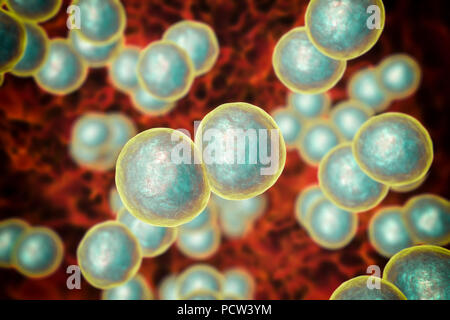Moraxella (Branhamella catarrhalis) batteri, illustrazione del computer. Questi sono aerobiche, Gram-negativi cocchi (sferica) di batteri che si trovano comunemente nelle membrane mucose dell'apparato respiratorio dei mammiferi, compresi gli esseri umani. In individui immunocompromessi o opportunistico, essi possono causare infezioni del tratto respiratorio. Questi includono la sinusite, una infiammazione delle membrane sinusale. Questo può anche portare a otite media, una infezione dell'orecchio medio. Il trattamento con antibiotici. Foto Stock