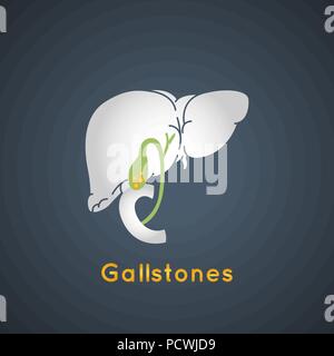 Vettore Gallstone icona logo illustrazione Illustrazione Vettoriale