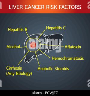 Il cancro al fegato fattori di rischio vettore icona logo illustrazione Illustrazione Vettoriale