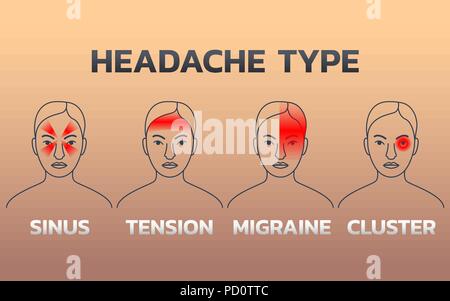 Tipi di mal di testa Infographics template design, icona illustrazione vettoriale Illustrazione Vettoriale