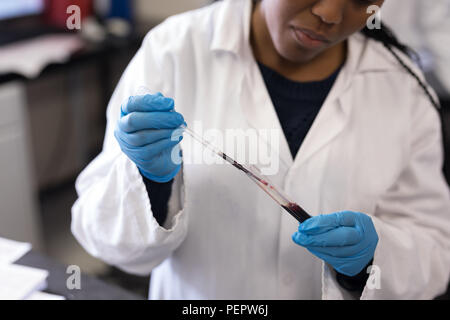 Tecnico di laboratorio di analisi di campioni di sangue Foto Stock