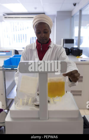 Tecnico di laboratorio di verifica del peso delle sacche di plasma Foto Stock