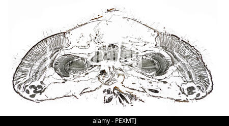 Occhi di fuco fly Eristalis tenax, tutta la sezione di testa, fotomicrografia in campo chiaro Foto Stock