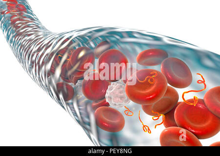 Ebola particelle di virus nel sangue, illustrazione del computer. Questo virus è la causa del virus ebola della malattia negli esseri umani e primati non umani. Si tratta di un grave e spesso fatale malattia con sintomi quali febbre, stanchezza, dolori muscolari, vomito, diarrea e emorragie (emorragia interna). Non vi è alcuna cura per questa malattia, ma i tre quarti dei pazienti può recuperare se dotato di sufficiente assistenza medica. Foto Stock