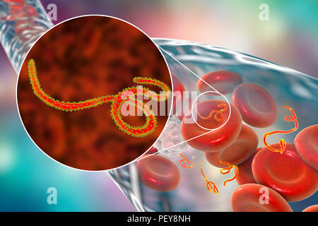 Ebola particelle di virus nel sangue, illustrazione del computer. Questo virus è la causa del virus ebola della malattia negli esseri umani e primati non umani. Si tratta di un grave e spesso fatale malattia con sintomi quali febbre, stanchezza, dolori muscolari, vomito, diarrea e emorragie (emorragia interna). Non vi è alcuna cura per questa malattia, ma i tre quarti dei pazienti può recuperare se dotato di sufficiente assistenza medica. Foto Stock