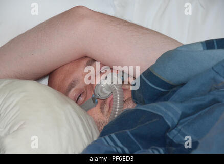 Questo Caucasian medioevo uomo indossa un naso maschera CPAP mentre giaceva a letto. Trattamento medico a casa per apnea nel sonno. Foto Stock