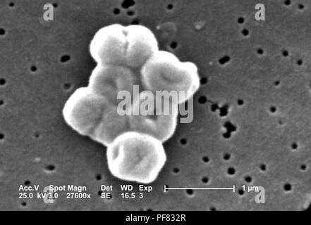 Gram-negativi, non-mobili Acinetobacter baumannii batteri hanno rivelato nel 27600x scansione ingrandita al microscopio elettronico (SEM) immagine, 2004. Immagine cortesia di centri per il controllo delle malattie (CDC) / Matteo J. Arduino, DrPH, Janice Carr, Jana Swenson. () Foto Stock