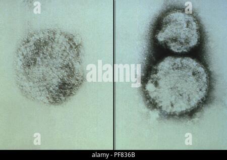 Tre Sin Nombre virus (SNV) virioni, membri del genere hantavirus, raffigurato nel colorato negativamente la trasmissione microscopiche di elettroni (TEM) immagine, 1993. Immagine cortesia di centri per il controllo delle malattie (CDC) / Charles D. Humphrey, Luanne Elliott. () Foto Stock