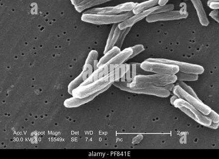 Dettagli ultrastrutturali di Gram-positivi di Mycobacterium tuberculosis batteri hanno rivelato nel 15549x scansione ingrandita al microscopio elettronico (SEM) immagine, 2006. Immagine cortesia di centri per il controllo delle malattie (CDC) / Ray Butler, MS, Janice Haney Carr. () Foto Stock