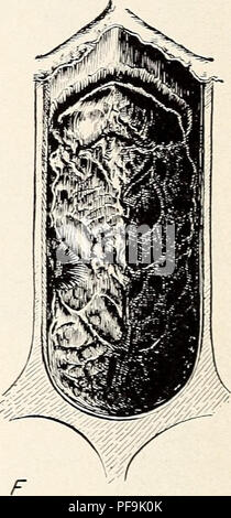 . La diagnosi di malattie delle api nell'apiario. Malattie delle api diagnosi. Figura 4.-i sintomi di peste americana in pupe: un sano, pupa; B-F, fasi di decadimento e essiccazione dei bozzoli, viste ventrale. Aspetto della covata morta l'aspetto e la posizione nelle celle di covata ucciso da xmeri- può peste sono notevolmente uniforme. Le larve morte giacciono ex- tendeva lungo la parete laterale inferiore con la loro estremità posteriore parte curva fino sul fondo delle cellule (fig. 3, G). Vi ma}t essere un piccolo rigonfiamento sollevato in prossimità della estremità di testa della scala, ma raramente. Si prega di notare che queste immagini sono extra Foto Stock