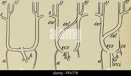 . Lo sviluppo del corpo umano : un manuale di embriologia umana. Embriologia; embrione, Non-Mammalian. 258 LO SVILUPPO DEL SISTEMA venoso e la cervicale vene laterali spostare la loro comunicazione cardinali per la jugulars, fino a quando il subclavians hanno quindi spostato, jugulars diventano molto più grandi di quelle dei cardinali. Quando il seno venoso è assorbito nella parete del padiglione auricolare destro, il corso della sinistra condotto Cuvierian diventa un po' più lungo di quello di destra e dalla giugulare sinistra, in corrispondenza del punto in cui essa è unita mediante la succlavia sinistra, un ramo deriva che si estendono Foto Stock