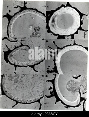 . Sviluppo di metodi cytochemical per lo studio della parete ascospore biogenesis e maturazione. Ascomycetes; delle ascospore; funghi. 113. Si prega di notare che queste immagini vengono estratte dalla pagina sottoposta a scansione di immagini che possono essere state migliorate digitalmente per la leggibilità - Colorazione e aspetto di queste illustrazioni potrebbero non perfettamente assomigliano al lavoro originale. Lusk, Demaris E.. Foto Stock