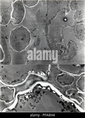 . Sviluppo di metodi cytochemical per lo studio della parete ascospore biogenesis e maturazione. Ascomycetes; delle ascospore; funghi. 106. Si prega di notare che queste immagini vengono estratte dalla pagina sottoposta a scansione di immagini che possono essere state migliorate digitalmente per la leggibilità - Colorazione e aspetto di queste illustrazioni potrebbero non perfettamente assomigliano al lavoro originale. Lusk, Demaris E.. Foto Stock