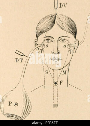 . Dictionnaire de physiologie. Fisiologia. AUDITION. .S7^&GT;. oto. ^ R lion des masticateurs et du tenseur auriculaire. L'ellort Ã"v la inasLicalion aiuÃ¹nc la con- synergique trazione du tenseur muscolare innervÃ© par le mÃªme nerf que les masticateurs, ainsi que le montre l'embryologie (M. Duval). Si l'ctrier est soudÃ©, rien n'est modifiÃ©. Par l'expÃ©rienct' de Valsalva, di'iA faite et Ã©tudit'-o Ã ce point de vue par Savart, le ton s'abaisse aussi; et il en est de incmc par la dÃ©glutition, le nez pincÃ© surtout. Toutes ces azioni ont pour elfet d'ac- croÃ®tre soit passivement, soit attivo Foto Stock