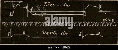 . Dictionnaire de physiologie. Fisiologia. 46^ CARDIOGRAPHE, le plateau systolique s'si allunga. (Voir la fig. 13 de Roy et Adami, reproduite ici Ã la fÃ®g. 21.) Roy et Adami arrivent à la conclusione assez dÃ©courageante Â" qu'il est difficile et mÃªme datifi la plupart des cas impossibile de mesurer avec l'esattezza la durÃ©e des diffÃ©rentes fasi du cycle cardiaque en s'en inquilino uniquement aux tracÃ©s du choc du cÅur Â" (Roy et Adami, ioc. cit., 244). Un HCrthle publiÃ© d'admirables tracÃ©s delÃ pression intra-ventriculaire et du choc du cÅur (recueillis chez le chien), sur lesquels on constate Foto Stock