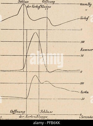 . Dictionnaire de physiologie. Fisiologia. CARDIOGRAPHE. ^59 SchU 3i3, 1892) un publiÃ© une sÃ©rie de tracÃ©s recueillis au moyen de l'appareil de HCrthle, et rappelant les ^'raphiques de HÃ"rthle et de Rolleston. FranÃ§ois Franck {A. de P., 1891, 765), E. Gley (A. de P., 1891, 734; B., 1894, 445), E. Meyer {sonda cardiographique pour la pression intra-ventriculaire chez lechiev, B., 1894, 443. Cardiographie chez le chien. A. de P., 1894, 692) ont dÃ©crit des sondes cardiographiques applicabili au cÅur du Chien et construites sur le modÃ¨le des sondes de Chauveau et Marey. Ces sondes fou