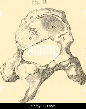 Questa pubblicazione dell'Accademia Imperiale delle Scienze descrive in dettaglio uno studio sulla scoliosi nei bambini, fornendo illustrazioni e spiegazioni dei cambiamenti strutturali nelle deformità spinali osservati nei giovani, con particolare attenzione alla scoliosi toracica. Foto Stock