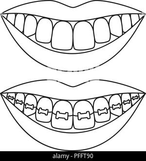 Line art in bianco e nero dei denti il concetto di allineamento Illustrazione Vettoriale