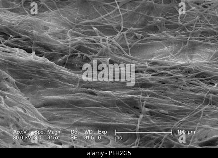 Dettagli ultrastrutturali sulla superficie di un non identificato nido di vespe trovati in Decatur, Georgia, ha rivelato nel 315x di scansione ingrandita al microscopio elettronico (SEM) immagine, 2006. Immagine cortesia di centri per il controllo delle malattie (CDC). () Foto Stock