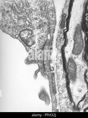 Capillari di cervello di topo sperimentalmente infettati per via endovenosa con Orientia tsutsugamushi rickettsial microrganismi, rivelato nella trasmissione microscopiche di elettroni (TEM) immagine, 1978. Immagine cortesia di centri per il controllo delle malattie (CDC) / Dr ed Ewing. () Foto Stock