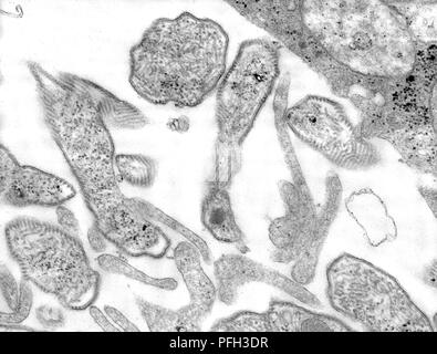 Dettagli ultrastrutturali dei virioni parotite coltivati in cellule Vero cultura, rivelato nella trasmissione microscopiche di elettroni (TEM) immagine, 1977. Immagine cortesia di centri per il controllo delle malattie (CDC) / A. Harrison e F. A. Murphy. () Foto Stock