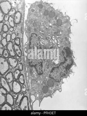 Capillari di cervello di topo sperimentalmente infettati per via endovenosa con Orientia tsutsugamushi rickettsial microrganismi, rivelato nella trasmissione microscopiche di elettroni (TEM) immagine, 1976. Immagine cortesia di centri per il controllo delle malattie (CDC) / Dr ed Ewing. () Foto Stock