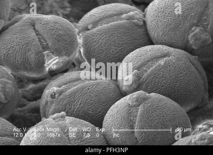 Morfologico ultrastruttura di granuli di polline trovato su un giallo "fuochi d'artificio' sundrops, Oenothera fruticosa fiore, rivelata nel 1687x di scansione ingrandita al microscopio elettronico (SEM) immagine, 2006. Immagine cortesia di centri per il controllo delle malattie (CDC) / Janice Haney Carr, Betsy gru. () Foto Stock