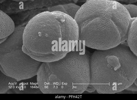 Morfologico ultrastruttura di granelli di polline trovati su un giallo "fuochi d'artificio' sundrops, Oenothera fruticosa fiore, rivelata nel 1648x di scansione ingrandita al microscopio elettronico (SEM) immagine, 2006. Immagine cortesia di centri per il controllo delle malattie (CDC) / Janice Haney Carr, Betsy gru. () Foto Stock