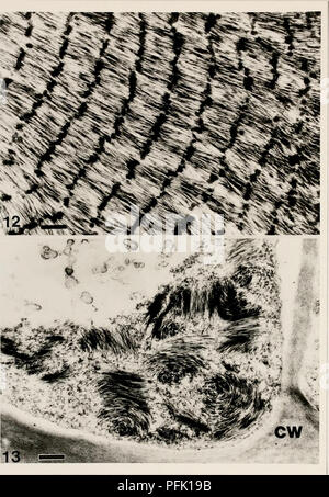 Questo studio si concentra sulle tecniche citologiche utilizzate per rilevare e identificare i virus delle orchidee, in particolare il Cymbidium Mosaic virus (CyMV). Le immagini di microscopia elettronica rivelano corpi di inclusione all'interno delle cellule di foglie di Cymbidium, contribuendo alla comprensione delle infezioni virali nelle orchidee. Foto Stock