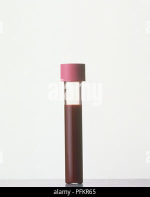Fiala di sangue Foto Stock