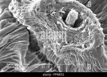 Superficie morfologiche caratteristiche di un 'dandelion clock' da un comune tarassaco (Taraxacum officinale pianta), raffigurata in 405x di scansione ingrandita al microscopio elettronico (SEM) immagine, 2006. Immagine cortesia di centri per il controllo delle malattie (CDC) / Janice Haney Carr. () Foto Stock