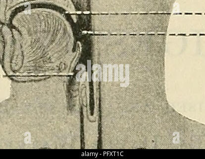 Questa illustrazione tratta dal Text-book of Anatomy di Cunningham si concentra sul sistema digerente, in particolare sul canale alimentare. Il diagramma delinea varie strutture anatomiche, tra cui la bocca, l'esofago e varie ghiandole correlate alla digestione, fornendo una comprensione fondamentale dell'anatomia umana. Foto Stock