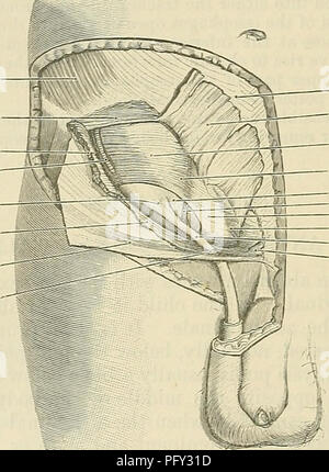 . Cunningham il libro di testo di anatomia. Anatomia. 1408 SUKFACE E ANATOMIA SUKGICAL. fibre muscolari del obliquo esterno, è un altro lieve depressione triangolare, che corrisponde a quello inferiore e parte stretta dell'aponeurosis del muscolo obliquo esterno. Vicino al disopra e quasi parallela alla metà mediale del legamento inguinale è il canale inguinale, attraversato dal funiculus spermatica (Fig. 1101); quest'ultimo può essere sentita ad emergere nel sottocutaneo anello inguinale immediatamente al di sopra del tubercolo pubico. Addominali e sottocutanea anelli inguinali sono state descritte completamente elsewher Foto Stock