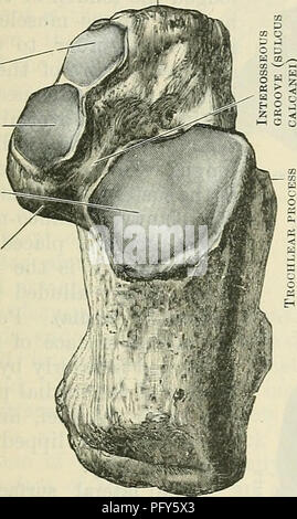 . Cunningham il libro di testo di anatomia. Anatomia. Il calcagno. 259 Il calcagno. Il calcagno è il più grande della zona tarsica ossa. Esso supporta l'astragalo sulla sua superficie dorsale e si articola con il cuboide anteriormente. Sull'aspetto plantare e dietro la sua estremità posteriore o la tuberosità (tuber calcanei), costituisce il tallone, su cui tanto grande una parte del peso del corpo si appoggia. L'asse lungo dell'osso si inclina in avanti e un po' lateralmente.   La superficie dorsale del calcagno è divisibile in due parti-una superficie posteriore non- articolare e parte anteriore una porzione articolare. La lunghezza del Foto Stock