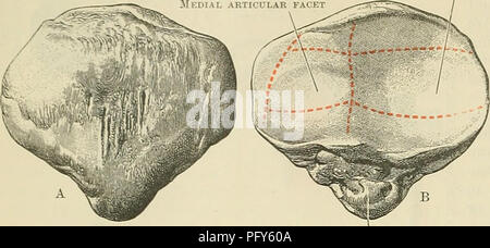 . Cunningham il libro di testo di anatomia. Anatomia. 246 OSTEOLOGIA. Laterali faccetta articolare. Di solito piana o leggermente convessa in senso trasversale. Di tanto in tanto, nell'osso macerate, indicazioni di una terza area verticale sono da notare lungo il bordo mediale dell'aspetto posteriore. In questo modo si definisce la parte della superficie articolare che si appoggia sul bordo laterale del condilo mediale in condizioni estreme di flessione. Nella condizione di recente, quando il componente femorale sur- faccia è rivestita di cartilagine, una più com- arraDgement plex delle faccette possono essere in alcuni casi (visualizzato come in- dicated in Fig. 244). Lamont {ufficiale di Anat. e Foto Stock