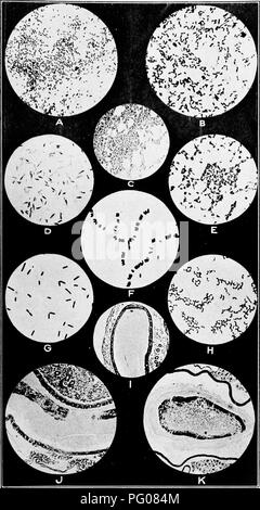 . Malattie delle api. Le api. Bui, 810, U. S. Dipartimento di Agricoltura. Piastra VII.. Foulbrooo europea.. Si prega di notare che queste immagini vengono estratte dalla pagina sottoposta a scansione di immagini che possono essere state migliorate digitalmente per la leggibilità - Colorazione e aspetto di queste illustrazioni potrebbero non perfettamente assomigliano al lavoro originale. Foto Stock