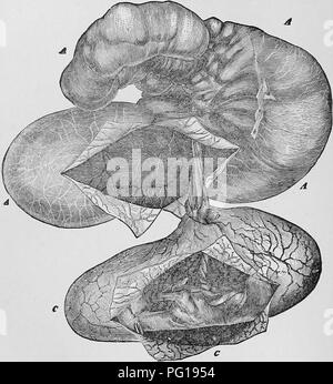 . Ostetricia veterinaria; un compendio per l'uso di studenti e professionisti. Ostetricia veterinaria. ^ , OSTETRICIA VETERINARIA. Di solito molto più facilmente che se a riposo per qualche tempo precedente.. Fig. 14. FcETUS del Mare e le sue buste. Un, Chorial Sac; C, sacco amniotico prelevato dalla cavità Allantoid, e aperta per esporre il feto; D, Infundibulum del Urachus; B, Allantoid porzione di cordone ombelicale; 6, la porzione di superficie esterna del corion bisognosi di bikunina Villosities e corret- sponding al punto di inserzione di tre pediculated Hippomanes. Un Mare con Foto Stock