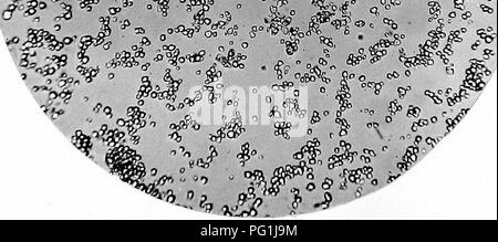 . Il principale amidi usato come cibo : illustrato con foto-micographys con una breve descrizione della loro origine e caratteri . Microscopia botanica; amido. 16.-KICE. X 160.. Si prega di notare che queste immagini vengono estratte dalla pagina sottoposta a scansione di immagini che possono essere state migliorate digitalmente per la leggibilità - Colorazione e aspetto di queste illustrazioni potrebbero non perfettamente assomigliano al lavoro originale. Griffiths, W. Cirencester [Inghilterra] : Baily &AMP; Figlio Foto Stock