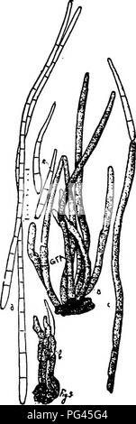 Questo lavoro esplora i funghi responsabili di varie malattie vegetali, descrivendo in dettaglio le caratteristiche di C. apii e la sua struttura a cellule spore. L'attenzione è rivolta alla comprensione dell'impatto delle infezioni fungine sulla salute delle piante e del loro ruolo nella scienza agricola. Foto Stock