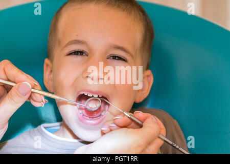 Close up boy avente i suoi denti esaminati da un dentista. Un bel ragazzo dal dentista. Igiene orale Foto Stock