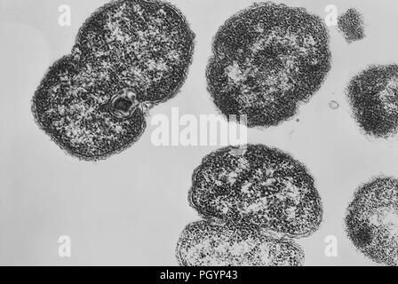 Gram-negativi Neisseria gonorrhoeae batteri hanno rivelato in una trasmissione microscopiche di elettroni (TEM) immagine, 1980. Immagine cortesia di centri per il controllo delle malattie (CDC) / Joe Miller. () Foto Stock