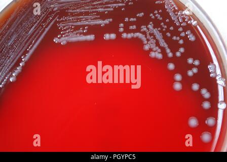 Morfologia coloniale di batteri Gram-negativi Yersinia pestis batteri cresciuti 72 ore su un mezzo di pecora agar di sangue (SBA), 2010. Immagine cortesia di centri per il controllo delle malattie (CDC) / Dr Todd Parker, Audra Marsh. () Foto Stock
