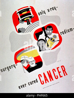 Metà del Novecento il cancro poster - Solo x-ray-- radium-- chirurgia-- sempre curato il cancro Foto Stock