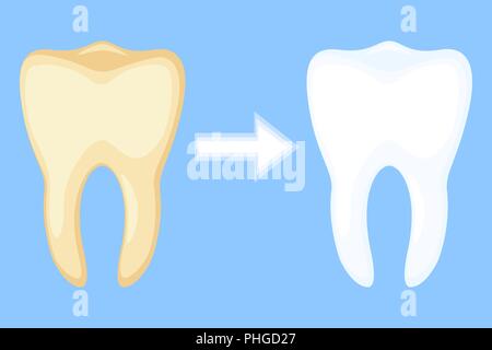 Lo sbiancamento dei denti concetto prima e dopo. Illustrazione Vettoriale